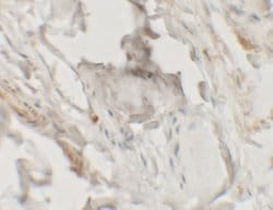 HHATL Polyclonal Antibody:Antibodies, Polyclonal