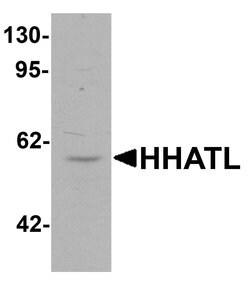 HHATL Polyclonal Antibody:Antibodies, Polyclonal