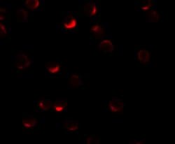 Invitrogen RILP Polyclonal Antibody 100 &mu;g; Unconjugated:Antibodies,