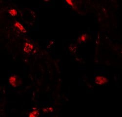 Invitrogen RILPL2 Polyclonal Antibody 100 &mu;g; Unconjugated:Antibodies,