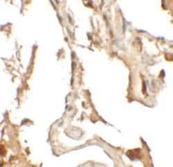 Invitrogen RILPL2 Polyclonal Antibody 100 &mu;g; Unconjugated:Antibodies,