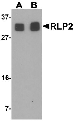 Invitrogen RILPL2 Polyclonal Antibody 100 &mu;g; Unconjugated:Antibodies,
