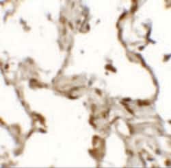 Invitrogen TFEB Polyclonal Antibody 100 &mu;g; Unconjugated:Antibodies,