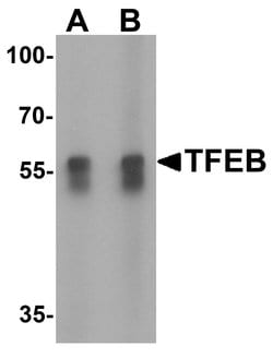 Invitrogen TFEB Polyclonal Antibody 100 &mu;g; Unconjugated:Antibodies,