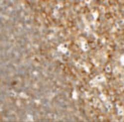 Invitrogen TFCP2L1 Polyclonal Antibody 100 &mu;g; Unconjugated:Antibodies,