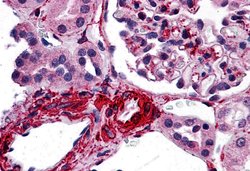 Invitrogen CARD10 Polyclonal Antibody 100 &mu;g; Unconjugated:Antibodies,
