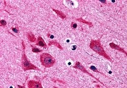 Invitrogen TAB2 Polyclonal Antibody 100 &mu;g | Buy Online | Invitrogen&trade; | Fisher Scientific