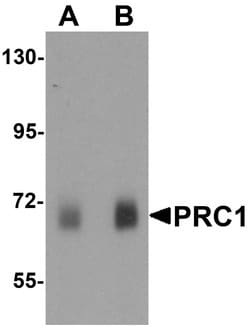PRC1 Polyclonal Antibody:Antibodies, Polyclonal