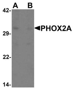 Invitrogen PHOX2A Polyclonal Antibody 100 &mu;g; Unconjugated:Antibodies,