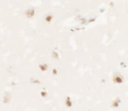 Invitrogen SHANK3 Polyclonal Antibody 100 &mu;g; Unconjugated:Antibodies,