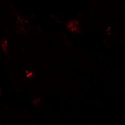 NBS1 Polyclonal Antibody:Anticuerpos