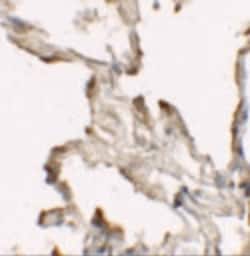 NBS1 Polyclonal Antibody:Anticuerpos