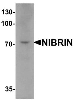NBS1 Polyclonal Antibody:Anticuerpos