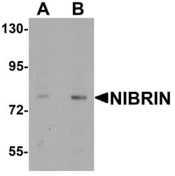 Invitrogen NBS1 Polyclonal Antibody 100 μg; Unconjugated:Antibodies,