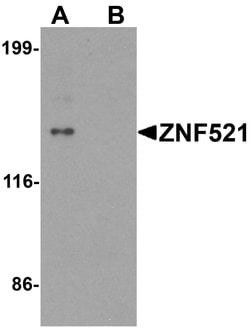 Invitrogen ZNF521 Polyclonal Antibody 100 &mu;g; Unconjugated:Antibodies,