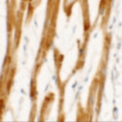 Invitrogen FCHO2 Polyclonal Antibody 100 &mu;g; Unconjugated:Antibodies,