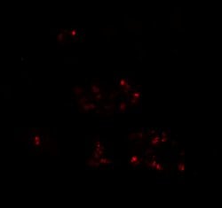 Invitrogen DBX2 Polyclonal Antibody 100 &mu;g; Unconjugated:Anticuerpos