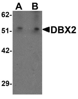Invitrogen DBX2 Polyclonal Antibody 100 &mu;g; Unconjugated:Anticuerpos