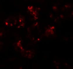 Invitrogen TTYH2 Polyclonal Antibody 100 &mu;g; Unconjugated:Antibodies,