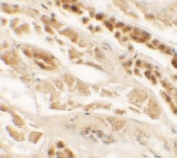 Invitrogen TTYH2 Polyclonal Antibody 100 &mu;g; Unconjugated:Antibodies,