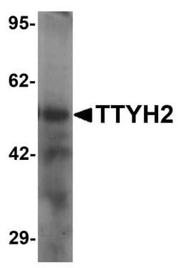 Invitrogen TTYH2 Polyclonal Antibody 100 &mu;g; Unconjugated:Antibodies,