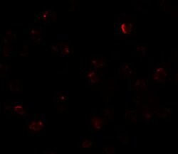 Invitrogen ZBTB40 Polyclonal Antibody 100 &mu;g; Unconjugated:Antibodies,