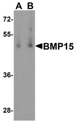 Invitrogen BMP-15 Polyclonal Antibody 100 &mu;g; Unconjugated:Antibodies,