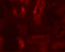 Invitrogen SARM Polyclonal Antibody 100 &mu;g; Unconjugated:Antikroppar