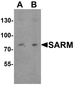Invitrogen SARM Polyclonal Antibody 100 &mu;g; Unconjugated:Antikroppar