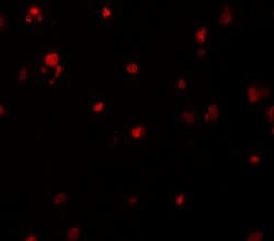 Invitrogen DELE Polyclonal Antibody 100 &mu;g; Unconjugated:Antibodies,