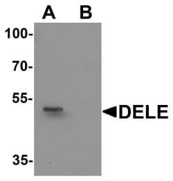 Invitrogen DELE Polyclonal Antibody 100 &mu;g; Unconjugated:Antibodies,