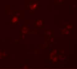 Invitrogen CCDC22 Polyclonal Antibody 100 &mu;g; Unconjugated:Antibodies,