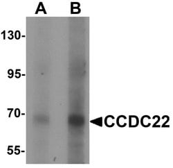 Invitrogen CCDC22 Polyclonal Antibody 100 &mu;g; Unconjugated:Antibodies,