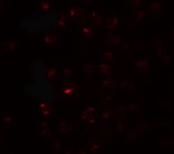 Invitrogen CLEC2A Polyclonal Antibody 100 &mu;g; Unconjugated:Antibodies,