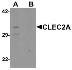Invitrogen CLEC2A Polyclonal Antibody 100 &mu;g; Unconjugated:Antibodies,