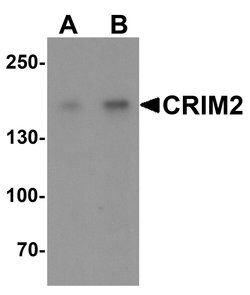 Invitrogen CRIM2 Polyclonal Antibody 100 &mu;g; Unconjugated:Antibodies,