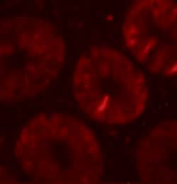 Invitrogen TOX Polyclonal Antibody 100 &mu;g; Unconjugated:Antibodies,
