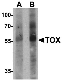 Invitrogen TOX Polyclonal Antibody 100 &mu;g; Unconjugated:Antibodies,