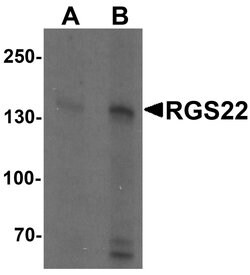 Invitrogen RGS22 Polyclonal Antibody 100 &mu;g; Unconjugated:Antibodies,