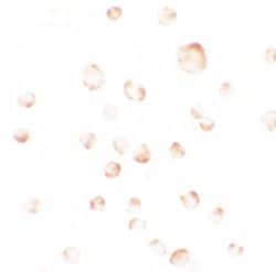 Invitrogen PHLPP1 Polyclonal Antibody 100 &mu;g; Unconjugated:Antibodies,