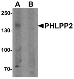 Invitrogen PHLPP2 Polyclonal Antibody 100 &mu;g; Unconjugated:Antibodies,