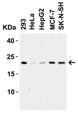 Invitrogen Claudin 4 Polyclonal Antibody 100 &mu;g; Unconjugated:Antibodies,