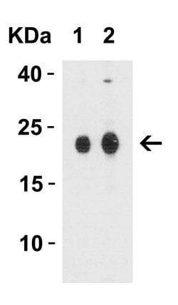 Invitrogen Claudin 4 Polyclonal Antibody 100 &mu;g; Unconjugated:Antibodies,
