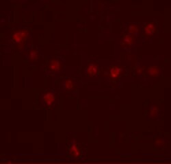 DDX60 Polyclonal Antibody