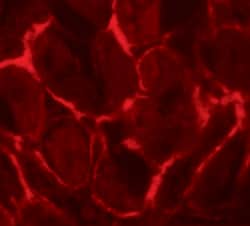 Invitrogen FLT3 Polyclonal Antibody 100 &mu;g; Unconjugated:Antibodies,