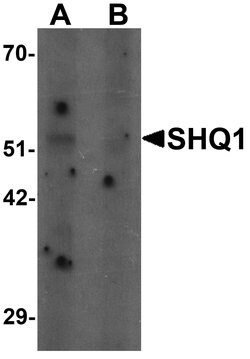 Invitrogen SHQ1 Polyclonal Antibody 100 &mu;g; Unconjugated:Antibodies,