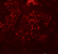 Invitrogen DCP2 Polyclonal Antibody 100 μg; Unconjugated:Antibodies,