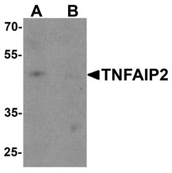 TNFAIP2 Polyclonal Antibody, Invitrogen 100 &mu;g; Unconjugated:Antibodies,