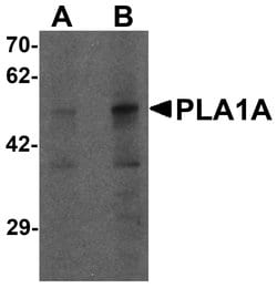Invitrogen PLA1A Polyclonal Antibody 100 μg; Unconjugated:Antibodies,