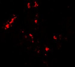 CMPK2 Polyclonal Antibody:Antibodies, Polyclonal